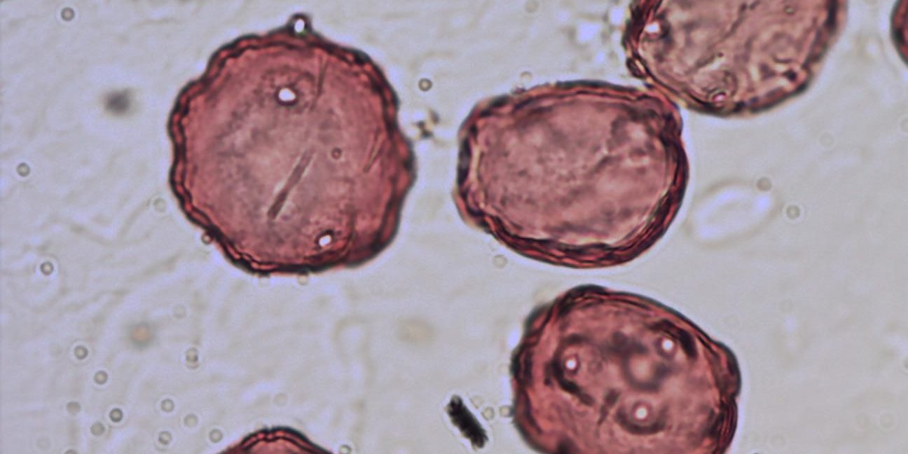 γυρεόκοκκος καρυδιάς